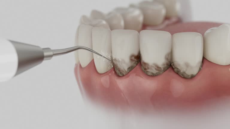 Trusted Dental Crowns And Bridges service in Westmont, NJ - Dentist Open Now